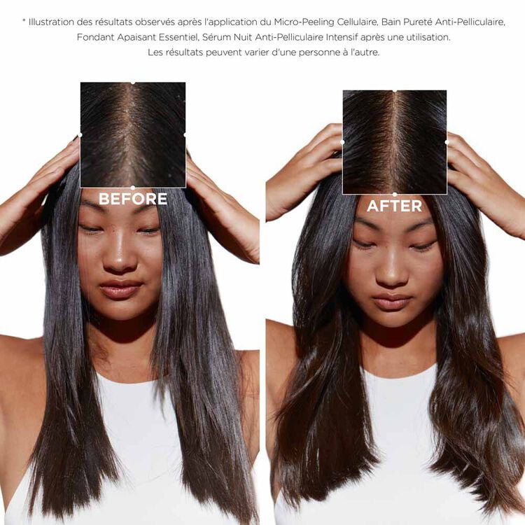 Bain Pureté Anti-Pelliculaire