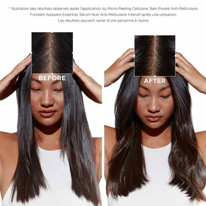 Sérum Cellulaire Nuit Anti-Pelliculaire Intensif