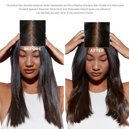 Trio Symbiose anti-pelliculaire cuir chevelu gras